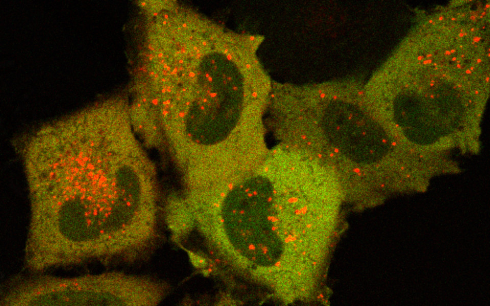 Wild-type Sgk3 (red) localizes to PI3P-decorated endosomes in HeLa cells. Sgk3 mutated in its PI3P binding site (green) localizes throughout the cytoplasm. Pokorny et al., Journal of Biological Chemistry (2021)