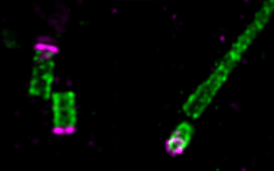 Centrioles in human RPE cells examined by expansion microscopy.