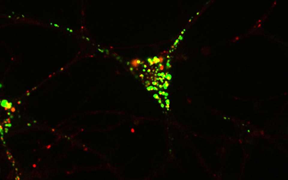 Microscopy picture of cortical neurons with autophagic structures labelled in green and red. (c) Sascha Martens, Max Perutz Labs