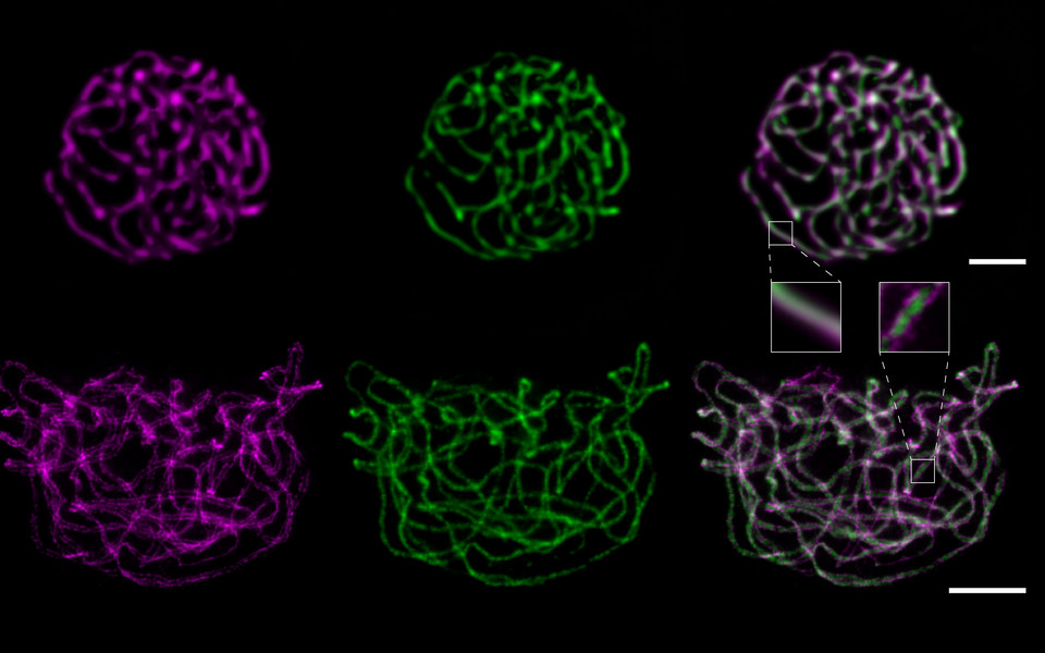 STED nanoscopy reveals substructures of the synaptonemal complex.