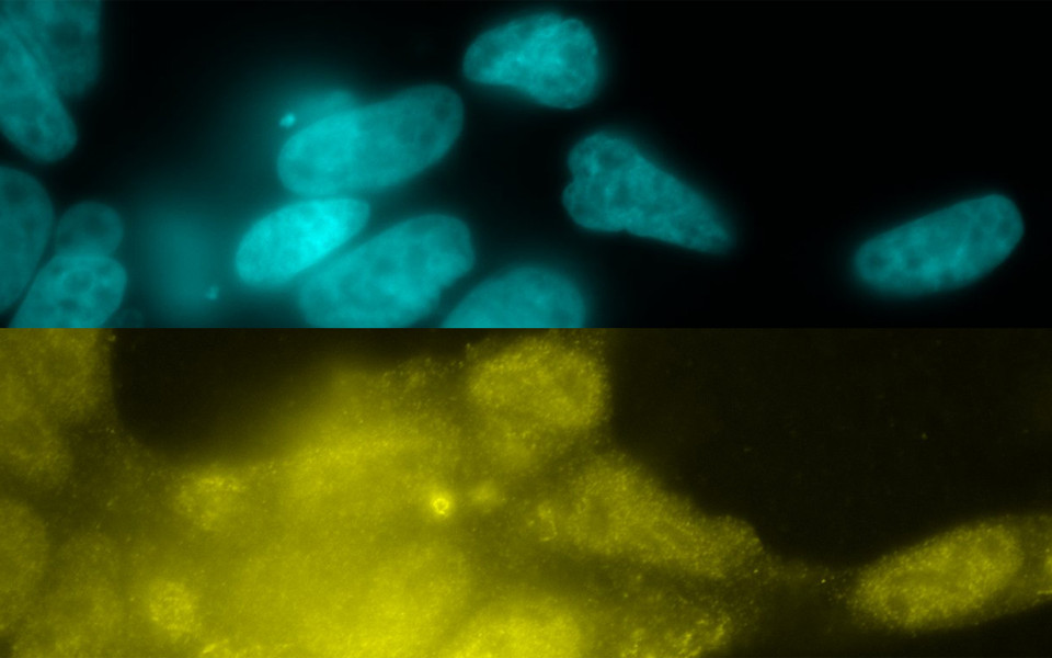 (c) Ingrid Frohner and Jiri Veis. Immunofluorescence stainings of human prostate cancer cells with PP2A A subunit antibody and nuclear counterstain with Hoechst.