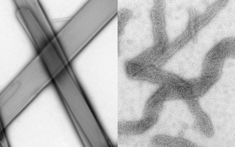 Negative Stain Electron Microscopy micrographs of MyD88 assemblies in the absence (left) or presence (right) of the Vaccinia Virus immunomodulator A46. (c) Daniel F. Azar, Max Perutz Labs